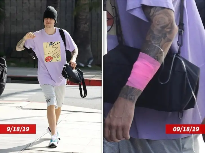 Justin Bieber foi diagnosticado com a doença de Lyme, diz site
